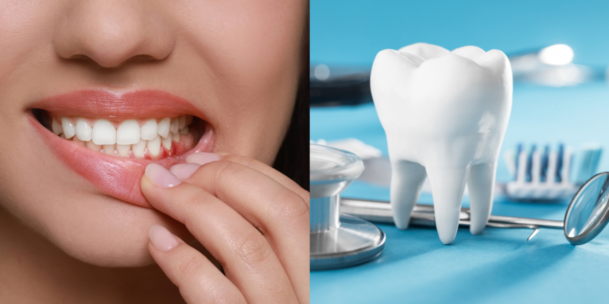 Choosing the Best Gum Treatment Turkey